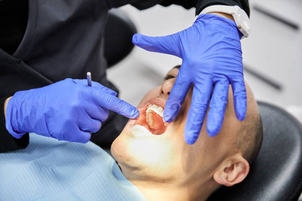 Best Emergency Root Canal Treatment in Ogden, KS